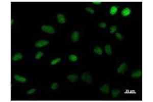 Immunostaining analysis in HeLa cells. (DDB2 抗体)