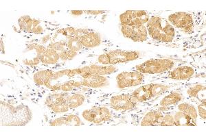 Detection of CDKN1A in Human Stomach Tissue using Polyclonal Antibody to Cyclin Dependent Kinase Inhibitor 1A (CDKN1A) (p21 抗体  (AA 1-164))