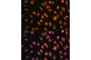 Immunofluorescence analysis of L929 cells using ELOVL4 Rabbit pAb (ABIN1679709, ABIN3017923, ABIN3017924 and ABIN6220305) at dilution of 1:100. (ELOVL4 抗体  (AA 1-100))