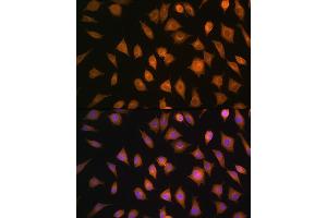 Immunofluorescence analysis of L929 cells using ELOVL4 Rabbit pAb (ABIN1679709, ABIN3017923, ABIN3017924 and ABIN6220305) at dilution of 1:100. (ELOVL4 抗体  (AA 1-100))