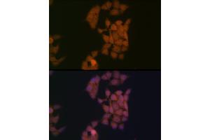 Immunofluorescence analysis of HeLa cells using Kaiso/ZBTB33 Rabbit mAb (ABIN7271437) at dilution of 1:100 (40x lens). (ZBTB33 抗体)