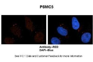 Sample Type :  Human brain stem cells  Primary Antibody Dilution :  1:500  Secondary Antibody :  Goat anti-rabbit Alexa-Fluor 594  Secondary Antibody Dilution :  1:1000  Color/Signal Descriptions :  PSMC5: Red DAPI:Blue  Gene Name :  PSMC5  Submitted by :  Dr. (PSMC5 抗体  (C-Term))