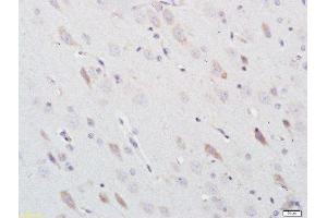 Paraformaldehyde-fixed, paraffin embedded rat brain, Antigen retrieval by boiling in sodium citrate buffer (pH6) for 15min, Block endogenous peroxidase by 3% hydrogen peroxide for 30 minutes, Blocking buffer (normal goat serum) at 37°C for 20min, Antibody incubation with Nitrotyrosine Polyclonal Antibody, Unconjugated  at 1:200 overnight at 4°C, followed by a conjugated secondary and DAB staining. (Nitrotyrosine 抗体)