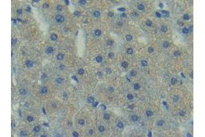 Detection of FAK in Human Liver Tissue using Polyclonal Antibody to Focal Adhesion Kinase (FAK)