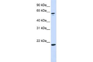 WB Suggested Anti-APRT Antibody Titration: 0. (APRT 抗体  (N-Term))