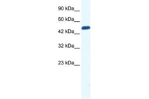 WB Suggested Anti-ZNF239 Antibody Titration:  0. (ZNF239 抗体  (N-Term))