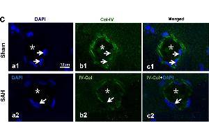 Immunofluorescence (IF) image for anti-Collagen, Type IV, alpha 3 (COL4A3) (AA 1571-1670) antibody (ABIN678128)