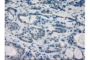 Immunohistochemical staining of paraffin-embedded endometrium tissue using anti-FRKmouse monoclonal antibody. (FRK 抗体)
