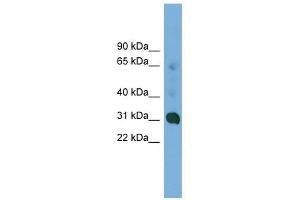 CCDC127 antibody used at 1 ug/ml to detect target protein. (CCDC127 抗体  (N-Term))