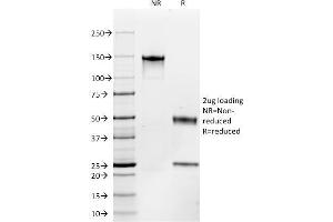 SDS-PAGE Analysis Purified CD117 Mouse Monoclonal Antibody (C117/370). (KIT 抗体)