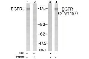 Image no. 1 for anti-Epidermal Growth Factor Receptor (EGFR) (Tyr1197) antibody (ABIN197463) (EGFR 抗体  (Tyr1197))