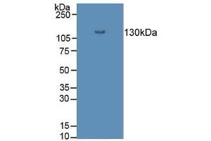 Detection of DSG3 in Porcine Skin Tissue using Polyclonal Antibody to Desmoglein 3 (DSG3) (Desmoglein 3 抗体  (AA 858-999))