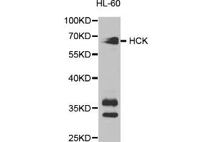Western blot analysis of extracts of HL-60 cells, using HCK antibody. (HCK 抗体)