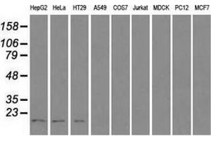 Western blot analysis of extracts (35 µg) from 9 different cell lines by using anti-CTAG1B monoclonal antibody. (CTAG1B 抗体)