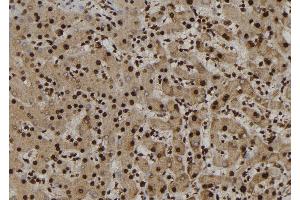 ABIN6277227 at 1/100 staining Human liver tissue by IHC-P. (NUP62 抗体  (Internal Region))