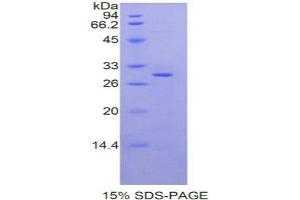 SDS-PAGE analysis of Rat Moesin Protein. (Moesin Protein (MSN))