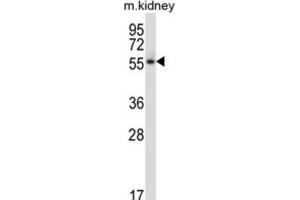 Western Blotting (WB) image for anti-Polo-Like Kinase 5 (PLK5) antibody (ABIN2997865) (PLK5 抗体)