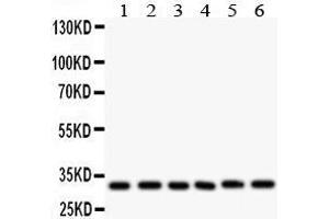 Anti- CASP3 antibody, Western blotting All lanes: Anti CASP3  at 0.