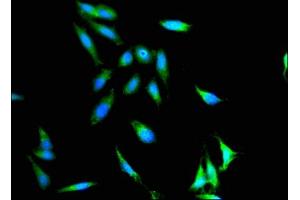Immunofluorescence (IF) image for anti-Integrin, alpha X (Complement Component 3 Receptor 4 Subunit) (ITGAX) (AA 100-350) antibody (ABIN7156472)