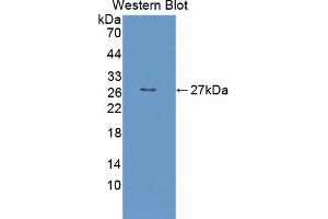 Western blot analysis of the recombinant protein. (EBI3 抗体  (AA 19-228))