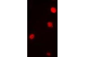 Immunofluorescent analysis of Ataxin 3 staining in Jurkat cells. (Ataxin 3 抗体)