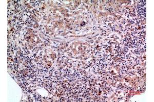 Immunohistochemistry (IHC) analysis of paraffin-embedded Human Lung, antibody was diluted at 1:100. (SCCA1/2 (Internal Region) 抗体)