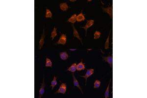 Immunofluorescence analysis of L929 cells using AVIL antibody (ABIN7265508) at dilution of 1:100. (Advillin 抗体  (AA 470-819))