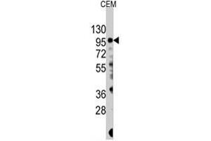 Western blot analysis of PIK3CG polyclonal antibody  in CEM cell lysate (35 ug/lane). (PIK3 gamma 抗体  (Ser1100))