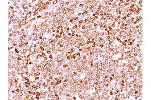 Formalin-fixed, paraffin-embedded human Tonsil stained with CD79a Rabbit Recombinant Monoclonal Antibody (IGA/1688R). (Recombinant CD79a 抗体  (AA 202-216))