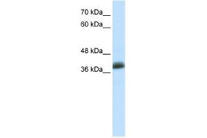 WB Suggested Anti-SAP30BP Antibody Titration:  0. (SAP30BP 抗体  (C-Term))