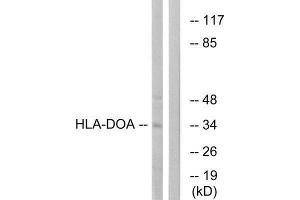 Western Blotting (WB) image for anti-HLA Class II DO alpha (HLA-DOA) (Internal Region) antibody (ABIN1851438) (HLA-DOA 抗体  (Internal Region))