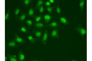 Immunofluorescence analysis of A549 cells using POLD1 antibody. (POLD1 抗体)