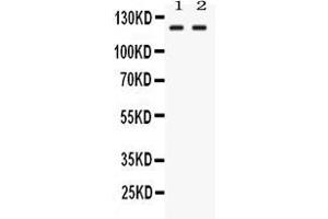 Western blot analysis of LRIG3 expression in rat testis extract ( Lane 1) and HEPG2 whole cell lysates ( Lane 2).