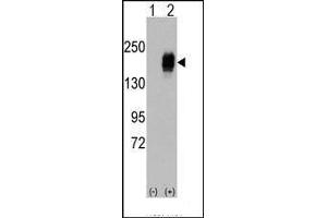 Western blot analysis of EGFR (arrow) using rabbit polyclonal EGFR Antibody. (EGFR 抗体  (Tyr987))