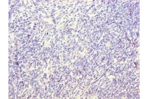 Immunohistochemistry of paraffin-embedded human thymus tissue using ABIN7171361 at dilution of 1:100 (TRIM 抗体  (AA 29-186))