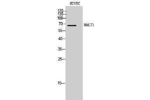 Western Blotting (WB) image for anti-Mucosa Associated Lymphoid Tissue Lymphoma Translocation Gene 1 (MALT1) (Internal Region) antibody (ABIN3180154) (MALT1 抗体  (Internal Region))