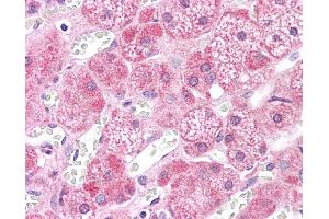 Immunohistochemistry (IHC) image for anti-Mitogen-Activated Protein Kinase Kinase 2 (MAP2K2) (N-Term) antibody (ABIN2783572) (MEK2 抗体  (N-Term))