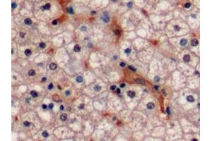 Detection of Ki-67 in Human Liver Tissue using Polyclonal Antibody to Ki-67 Protein (Ki-67) (Ki-67 抗体  (AA 2815-2928))