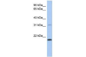 WB Suggested Anti-CLECL1 Antibody Titration: 0. (CLECL1 抗体  (Middle Region))
