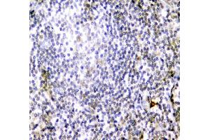 IHC analysis of CD84 using anti-CD84 antibody (ABIN6719602).