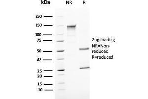 SDS-PAGE Analyis Purified Uroplakin 1B Mouse Monoclonal Antibody (UPK1B/3081). (Uroplakin 1B 抗体  (AA 109-229))
