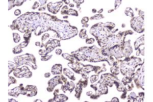 IHC analysis of TCP1 alpha using anti-TCP1 alpha antibody . (TCP1 alpha/CCTA 抗体  (C-Term))