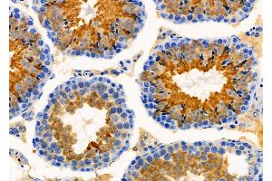 ABIN6260461 and ABIN6276363 at 1/100 staining Mouse testis tissue by IHC-P. (CARD8 抗体  (Internal Region))