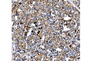 IHC analysis of MDH2 using anti-MDH2 antibody (ABIN7602618).