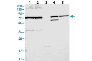 Western blot analysis of Lane 1: RT-4, Lane 2: U-251 MG, Lane 3: Human Plasma, Lane 4: Liver, Lane 5: Tonsil with FAM161B polyclonal antibody  at 1:250-1:500 dilution. (FAM161B 抗体)