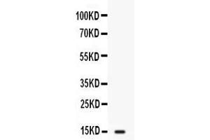 Western blot analysis of FABP2/I-FABP expression in SW620 whole cell lysates ( Lane 1). (FABP2 抗体  (N-Term))