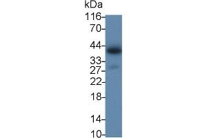 Detection of IL2Rg in Porcine Lymph node lysate using Polyclonal Antibody to Interleukin 2 Receptor Gamma (IL2Rg) (IL2RG 抗体  (AA 23-262))