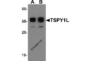 Western Blotting (WB) image for anti-TSPY1L (C-Term) antibody (ABIN1077408) (TSPY1L (C-Term) 抗体)
