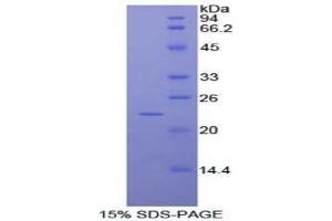 SDS-PAGE analysis of Human RAD54 Like Protein 2 Protein. (ARIP4 蛋白)
