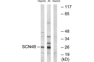 Western blot analysis of extracts from HepG2 cells and Jurkat cells, using SCN4B antibody. (SCN4B 抗体  (Internal Region))